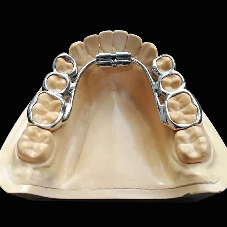 Dental Removable Rapid Palate Expander suppliers