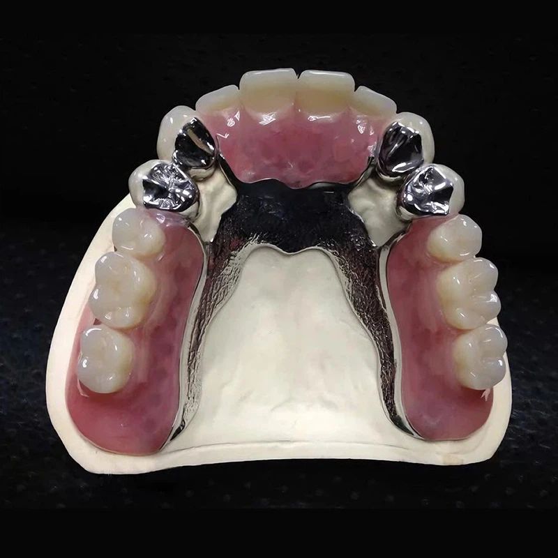 Dental CoCr Metal Framework